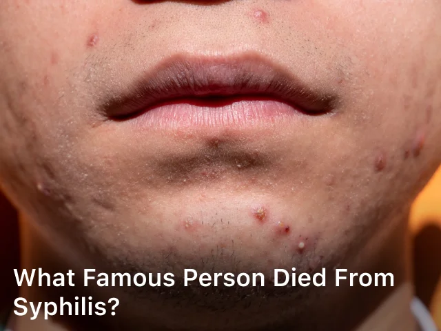 What Famous Person Died from Syphilis?