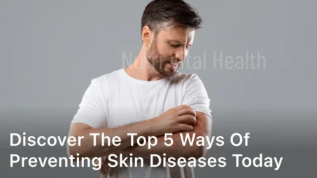 Discover the Top 5 Ways of Preventing Skin Diseases Today
