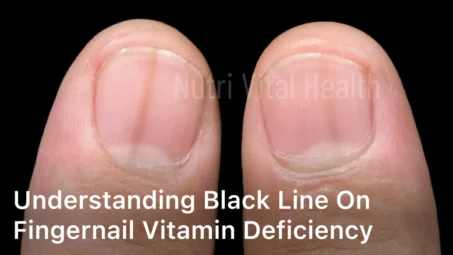 Understanding Black Line on Fingernail Vitamin Deficiency