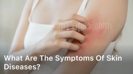 What are The Symptoms of Skin Diseases