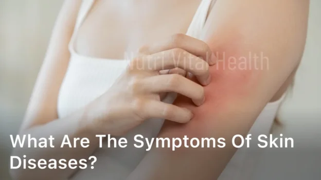What are The Symptoms of Skin Diseases