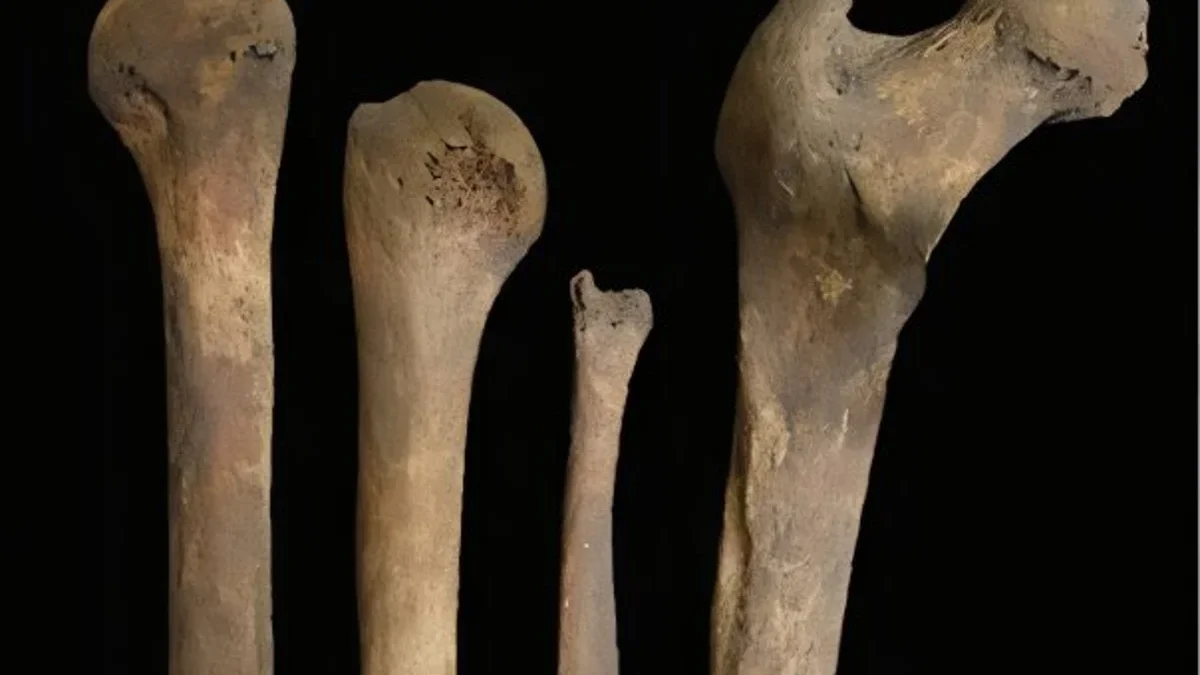 Evidence-of-postmortem-manipulation-on-bones