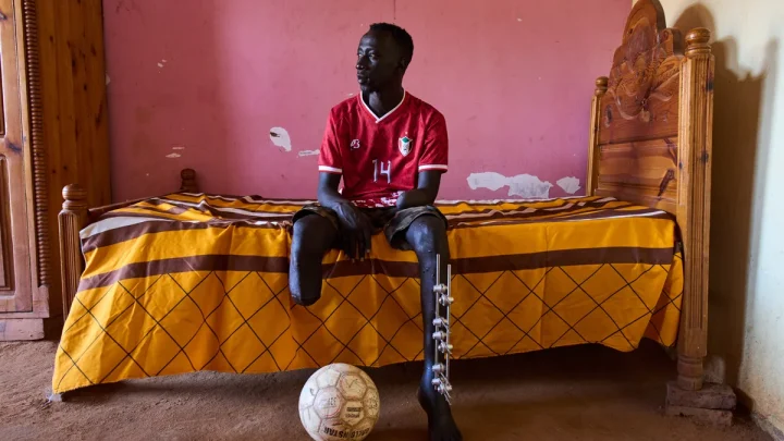 The scars of war among survivors in Sudan